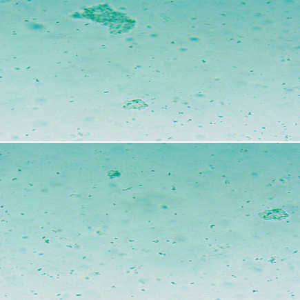 Microorganisms coffee Microorganisms coffee